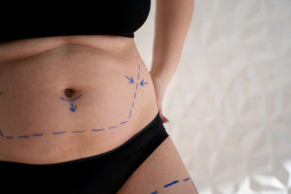Comment redessiner ses contours de hanches pour affiner sa silhouette